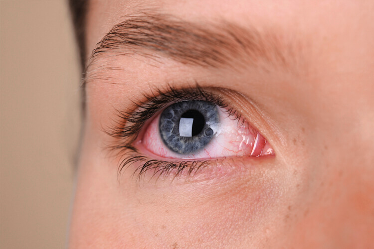 Cirurgia de Retina e Vítreo | COH